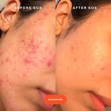 Tower 28 Beauty Mini SOS Daily Rescue Facial Spray 30 ml